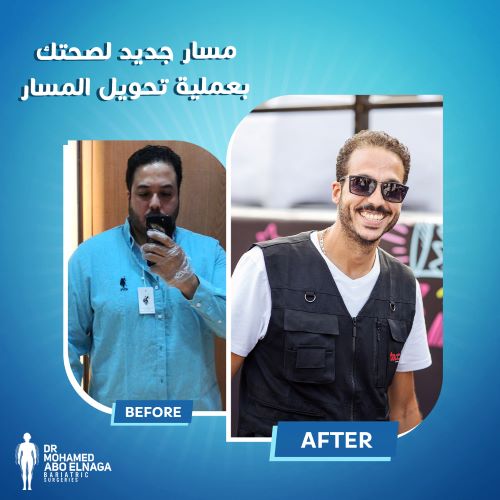 تجارب عملية تحويل المسار